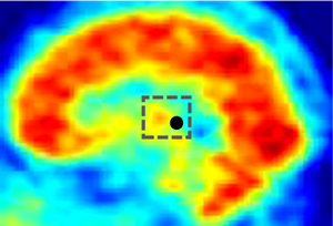 Типичное расположение центра масс ОФЭКТ изображения головного мозга